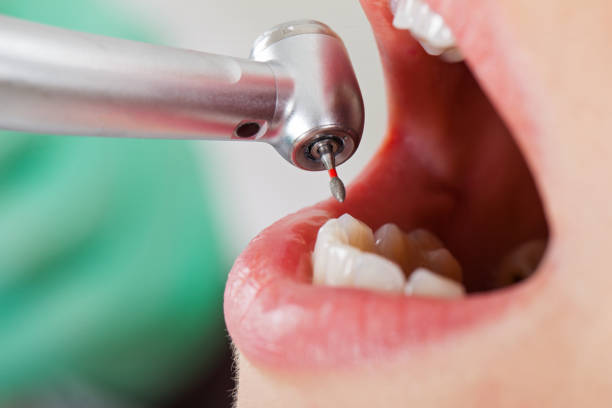 Best Urgent Tooth Repair  in Sweetwater, FL